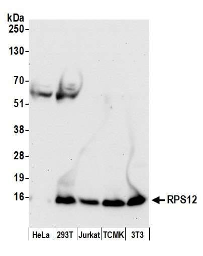 RPS12 / Ribosomal Protein S12 Antibody (aa25-75)