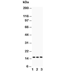 Polyclonal Rabbit anti-Human BIRC5 / Survivin Antibody (WB)