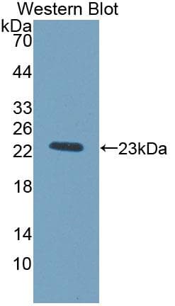 TIMP1 Antibody (aa24-197, Biotin)