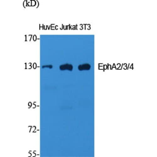 EPH Receptor A2+A3+A4 Antibody (530-610 aa)