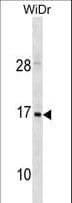 Polyclonal Rabbit anti-Human HBZ Antibody (aa95-123, WB)