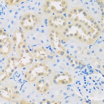 LETMD1 / HCCR1 Antibody