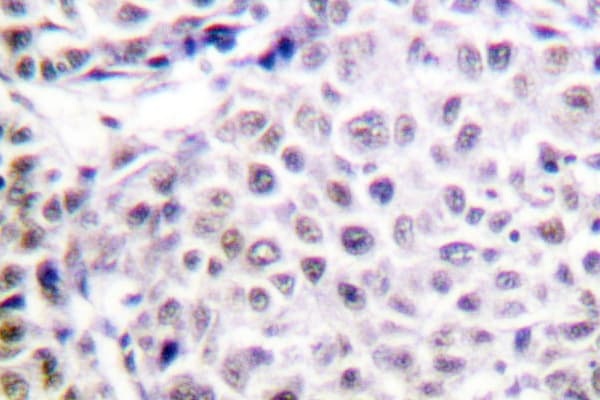 Polyclonal Rabbit anti-Human AURKB / Aurora-B Antibody (Tyr8, IHC, IF, WB)