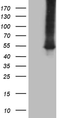 ASS1 / ASS Antibody (C-Terminus, clone OTI12G1)