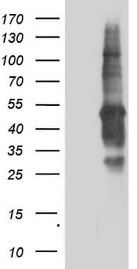 TACC2 Antibody (aa727-1026, clone OTI2A10)