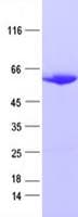 Human PHGDH Protein (Recombinant DDK,C-terminus)