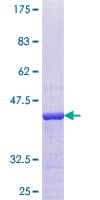 Human APITD1 Protein (Recombinant GST)