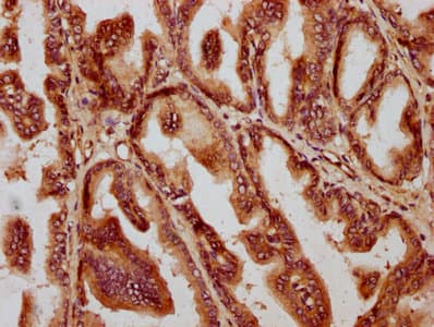AMH / Anti-Mullerian Hormone Antibody (aa26-560)