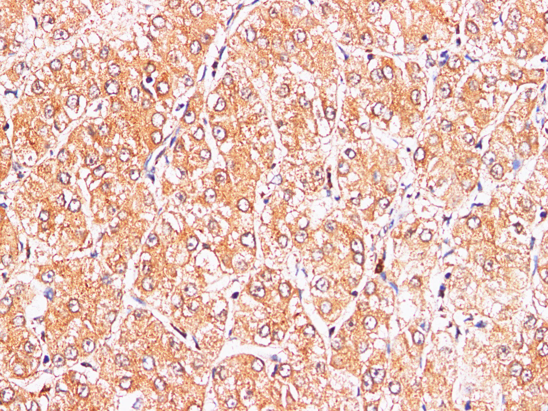 Polyclonal Rabbit anti-Rat S100A9 / MRP14 Antibody (IHC, WB)