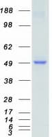 Human STK32B Protein (Recombinant Myc-DDK (Flag))