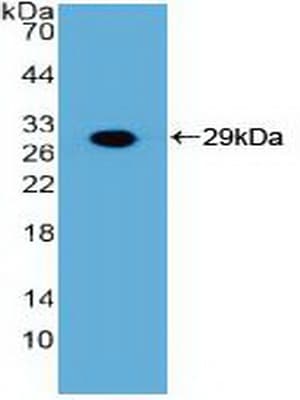 FGFR3 Antibody (aa166-375)