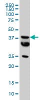 MCAT Antibody (clone 2F2)