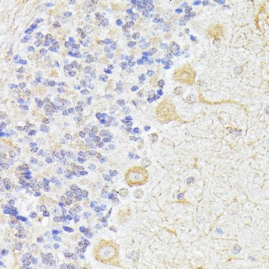 ELP3 Antibody