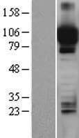 ITIH4 Protein (Over-Expression Lysate Myc-DDK (Flag))