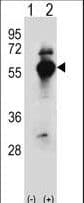 DARS Antibody (aa154-183)