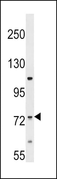ERI2 / EXOD1 Antibody (aa444-472)