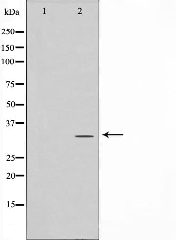 RPA2 / RFA2 / RPA34 Antibody (phospho-Thr21)
