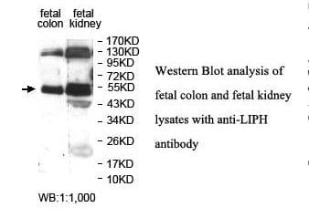 LIPH / Lipase Member H Antibody (aa108-273)