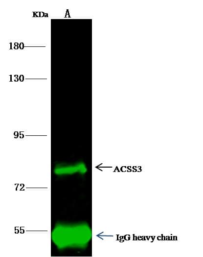 Polyclonal Rabbit anti-Human ACSS3 Antibody (Preservative Free, IHC, WB)