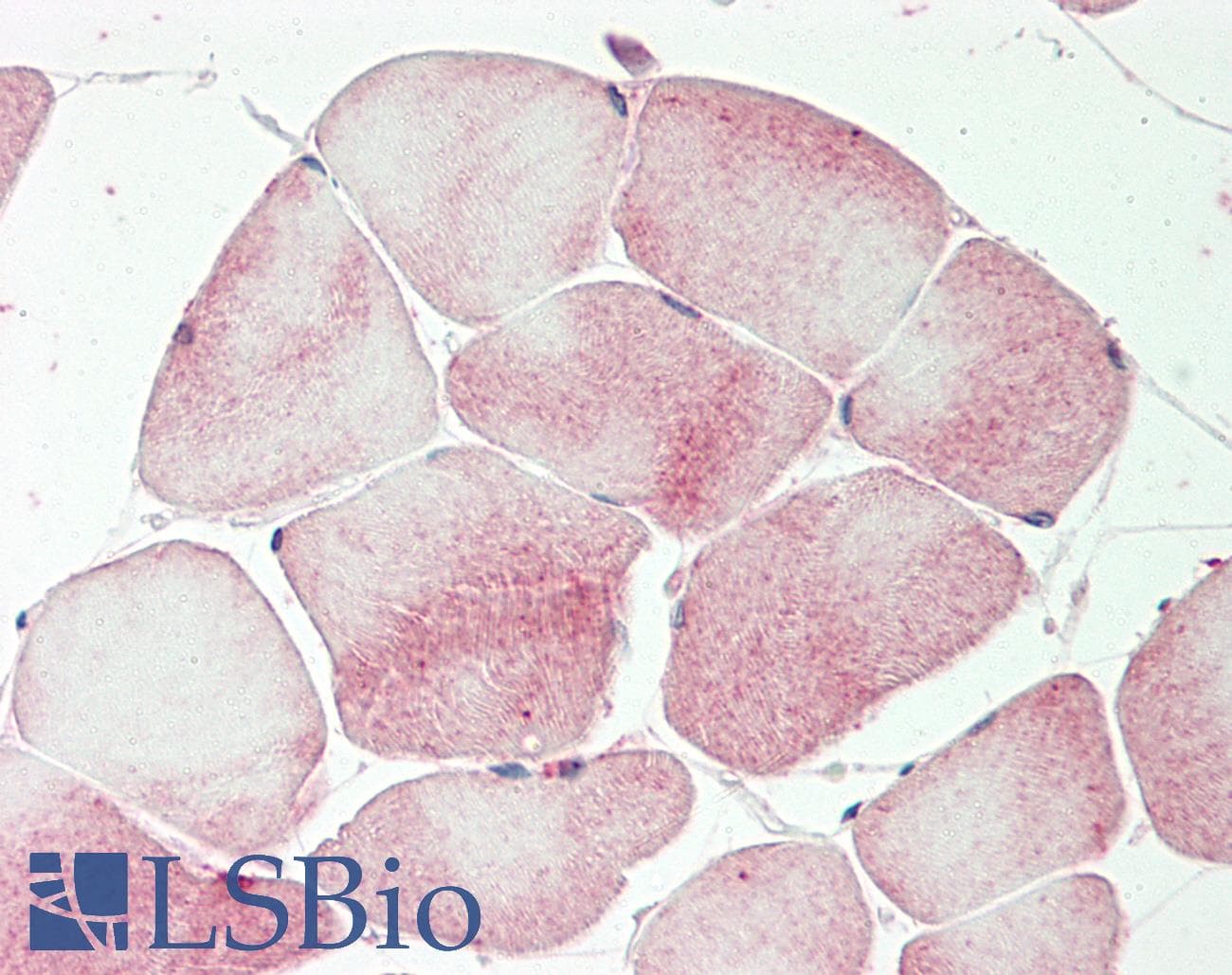 Polyclonal Rabbit anti-Human AIRE Antibody (N-Terminus, IHC, WB)