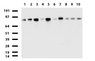 MCAM / CD146 Antibody (clone UMAB155)