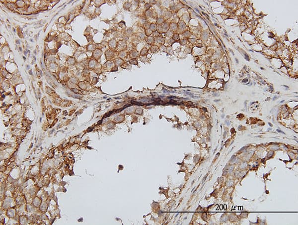 PIKFYVE / PIP5K Antibody (clone 6C7)