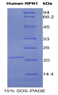 Human RPN1 / Ribophorin I Protein (Recombinant His)