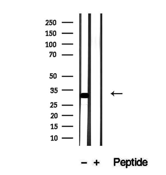 HIST1H1C Antibody