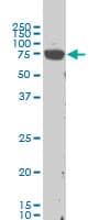Monoclonal Mouse anti-Human LIMK1 / LIMK Antibody (clone 1B2, WB)