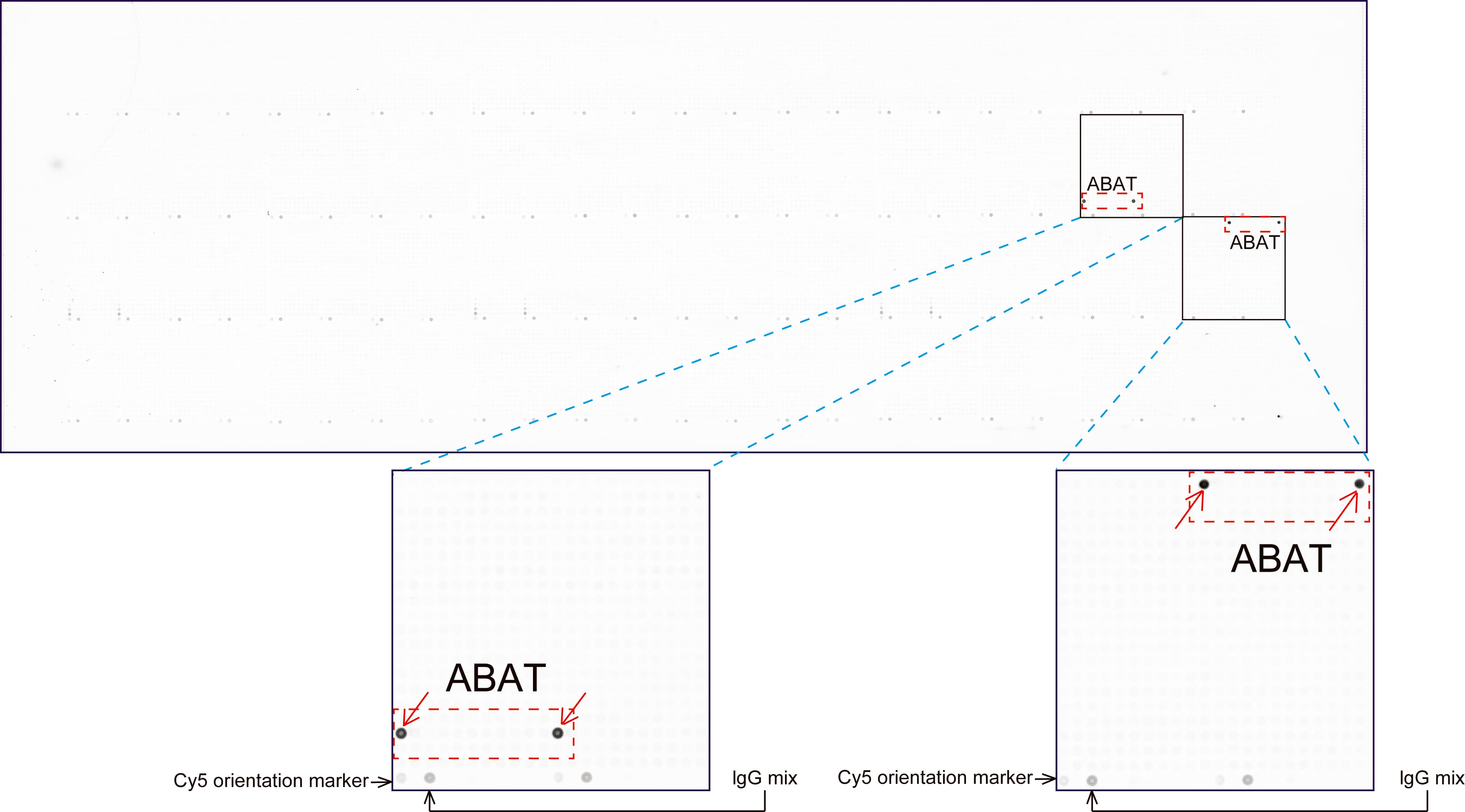 ABAT Antibody (aa29-323, clone UMAB178, Carrier-free)