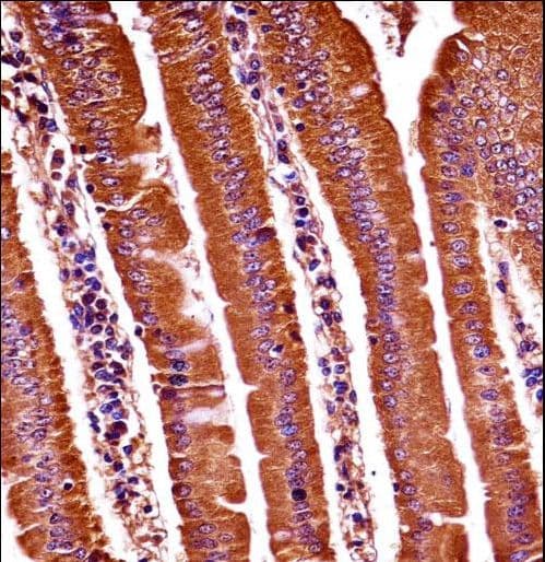 OXSR1 / OSR1 Antibody (aa94-121)