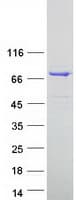 Human ESRP1 / RBM35A Protein (Recombinant Myc-DDK (Flag))
