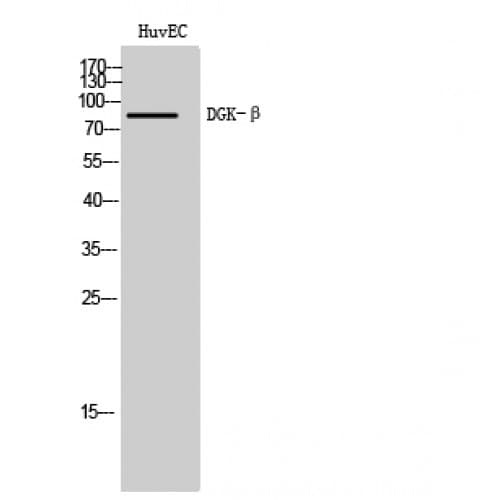 DGKB / DGK Beta Antibody (630-710 aa, C-terminal)