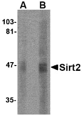 IHC-plus™ Polyclonal Rabbit anti-Human SIRT2 / Sirtuin 2 Antibody (IHC, IF, WB)