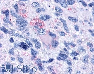 PathPlus™ Polyclonal Rabbit anti-Human GPR80 / GPR99 / OXGR1 Antibody (Extracellular Domain, IHC)