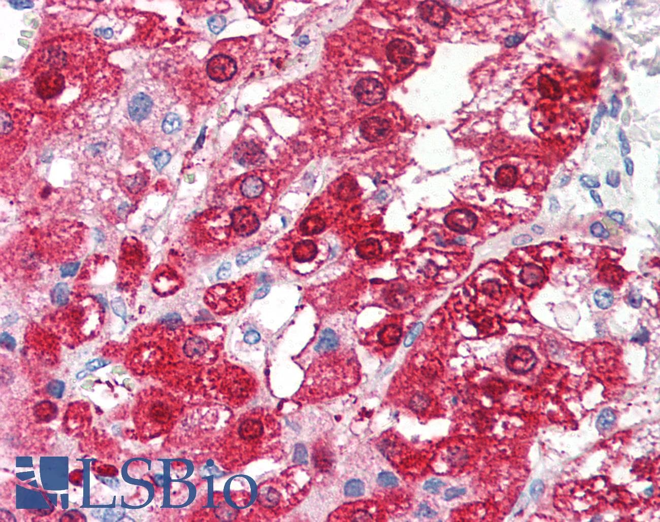 IHC-plus™ TRM3 / TARBP1 Antibody