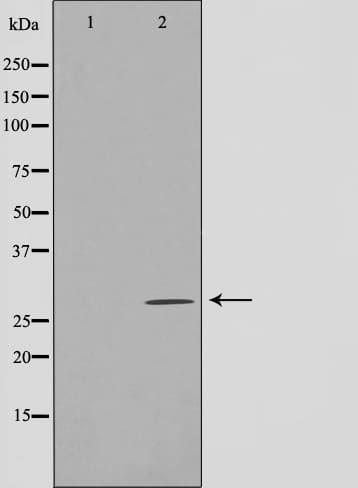 Polyclonal Rabbit anti-Human LRAT Antibody (IHC, IF, WB)