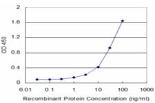 IHC-plus™ Monoclonal Mouse anti-Human CSTB / Cystatin B / Stefin B Antibody (clone M1-C1, IHC, WB)