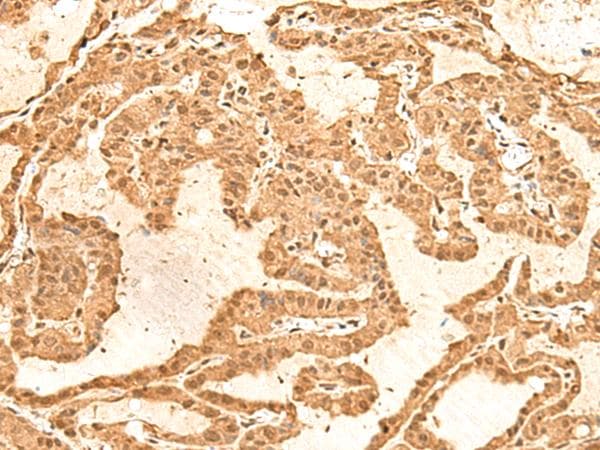 TIPRL / TIP Antibody