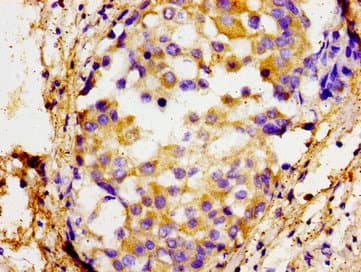 SOX11 Antibody