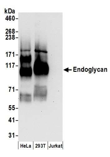 Polyclonal Rabbit anti-Human PODXL2 / Endoglycan Antibody (aa300-350, WB)