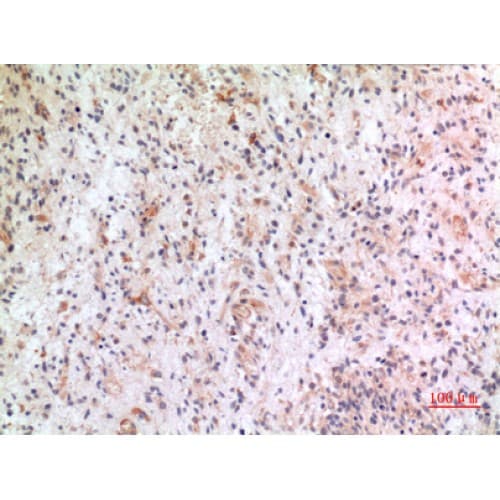 CX3CL1 / Fractalkine Antibody (221-270 aa, Internal)