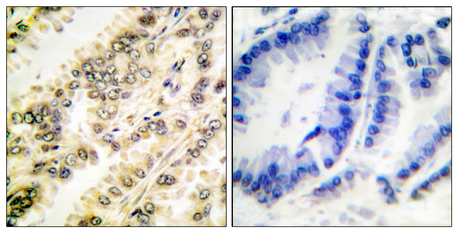 SGK1 / SGK Antibody (phospho-Ser422)
