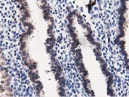 Dipeptidyl Peptidase 3 / DPP3 Antibody (clone OTI2D9)