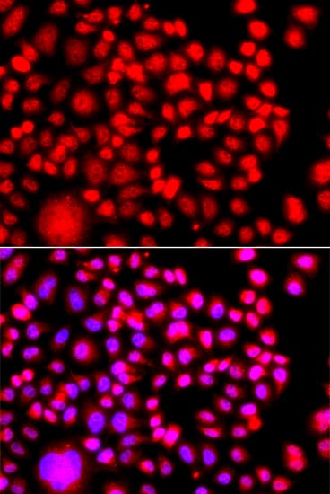 Polyclonal Rabbit anti-Human TESK2 Antibody (IHC, IF, WB)