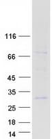 Human RS1 / Retinoschisin 1 Protein (Recombinant Myc-DDK (Flag))