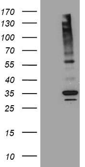 Monoclonal Mouse anti-Human ABCB1 / MDR1 / P Glycoprotein Antibody (clone OTI16D9, aa995-1280, IHC, WB)