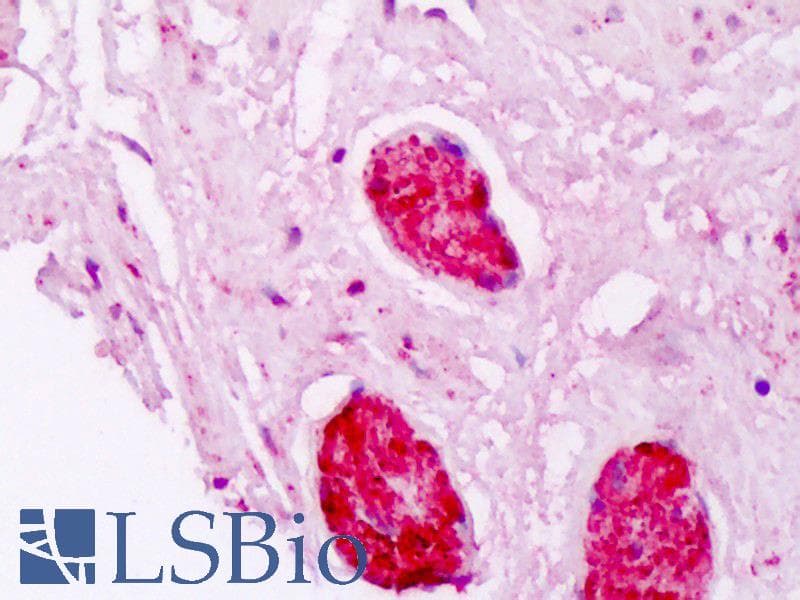 IHC-plus™ CRYAB / Alpha B Crystallin Antibody