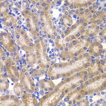 p66 / SHC Antibody