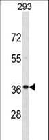 TNNT3 Antibody (aa217-245)